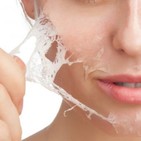 Mejorando mi piel con peeling quÍmico y vitaminas