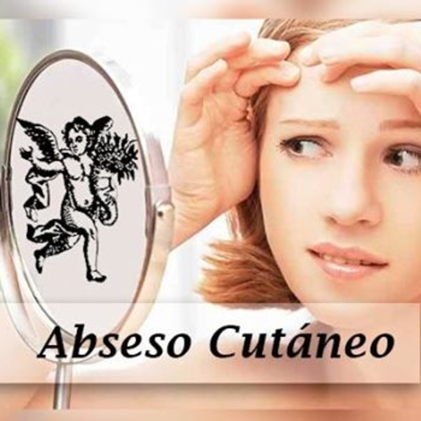 El Ángel De Tu Salud Absceso CutÁneo En El Ángel De Tu Salud En Mp30202 A Las 193706 48 4111