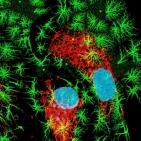 La Brújula de la Ciencia s04e06: Nobel de Química 2014 por superar los límites del microscopio