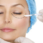 Blefaroplastia: Reparación de los párpados