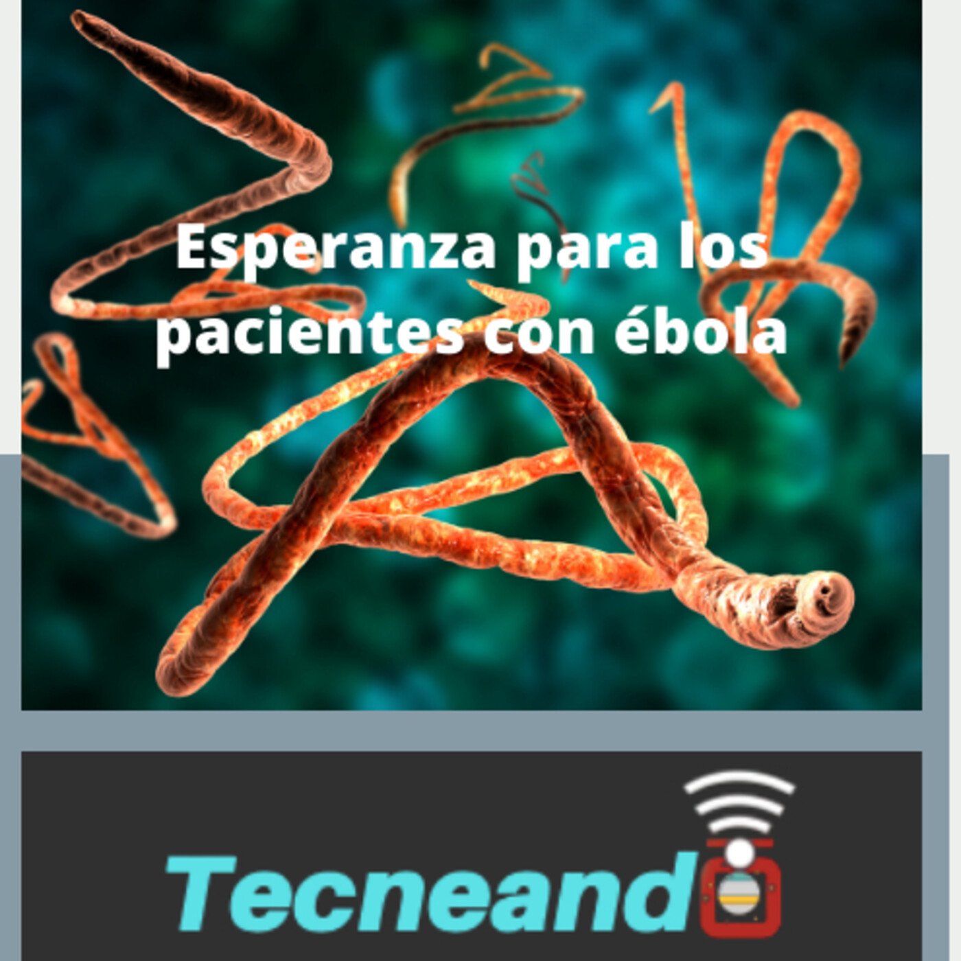 Tecneando