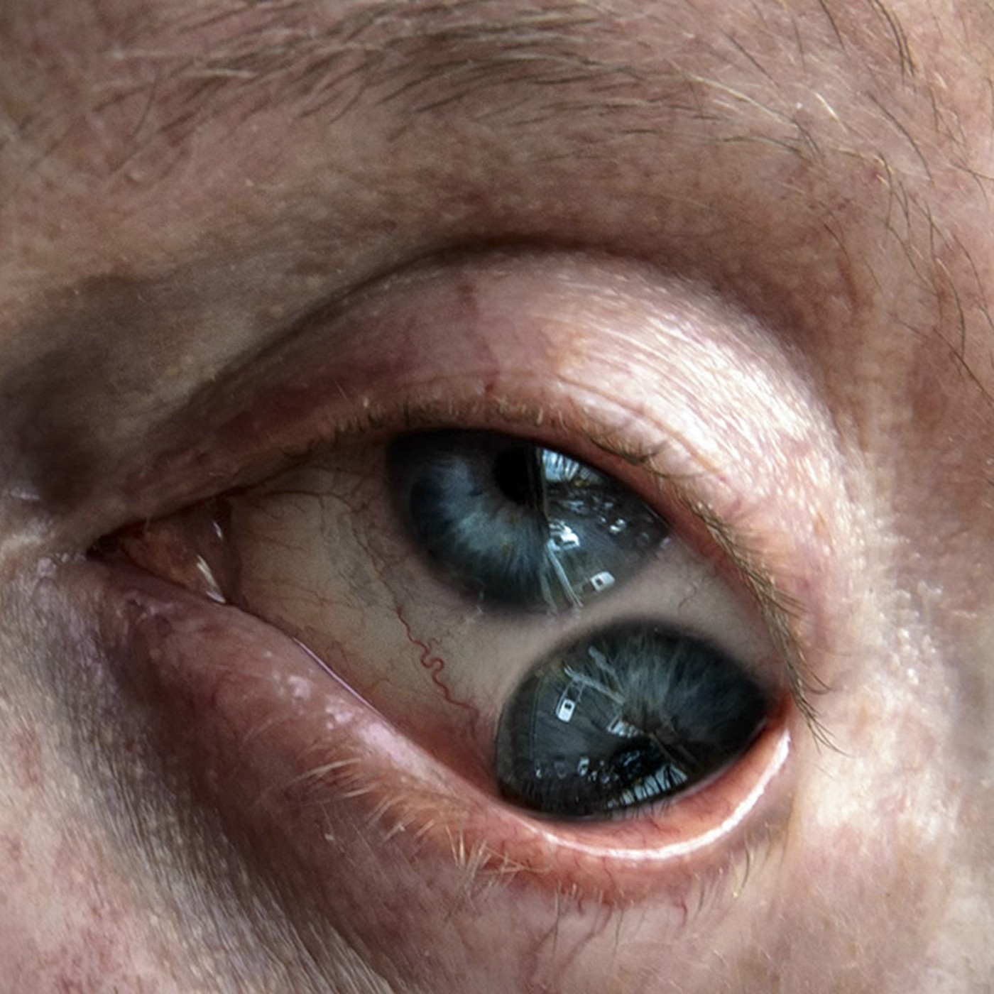 Ojo de Pez