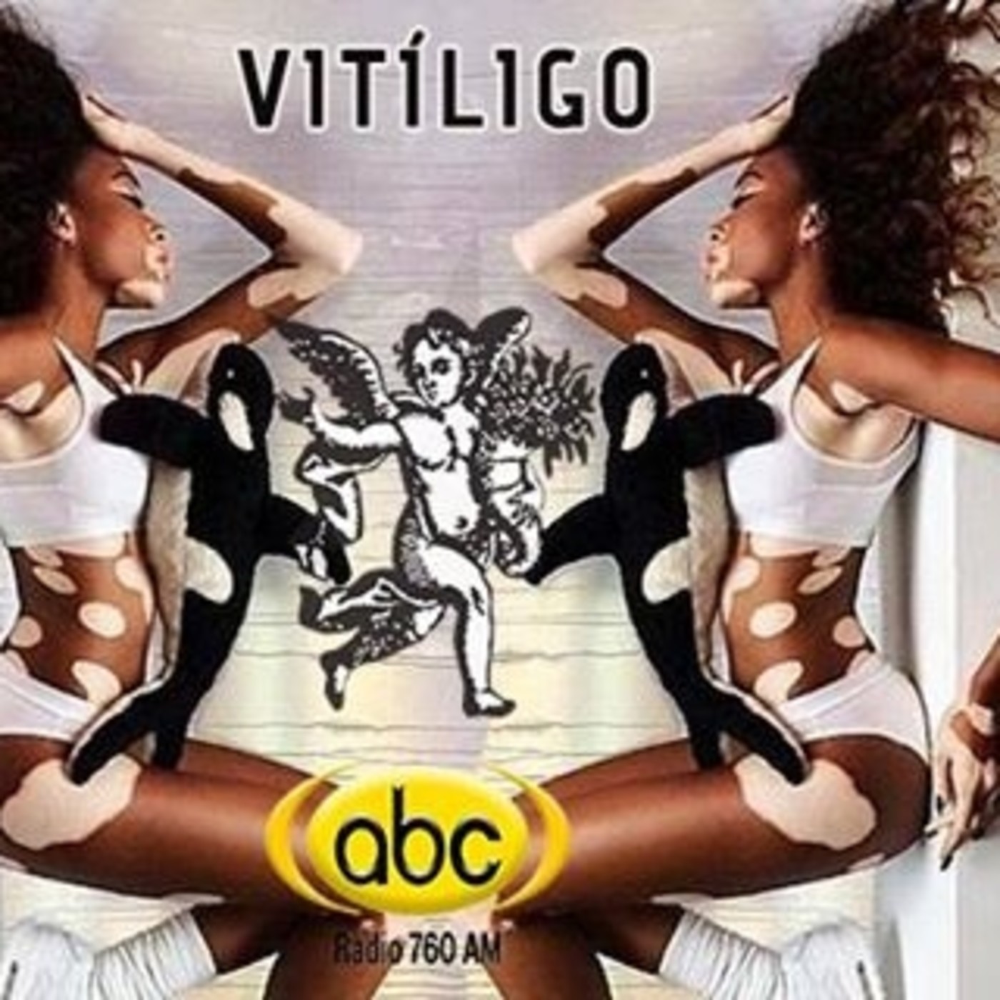 El Ángel de tu Salud - VITÍLIGO episode artwork