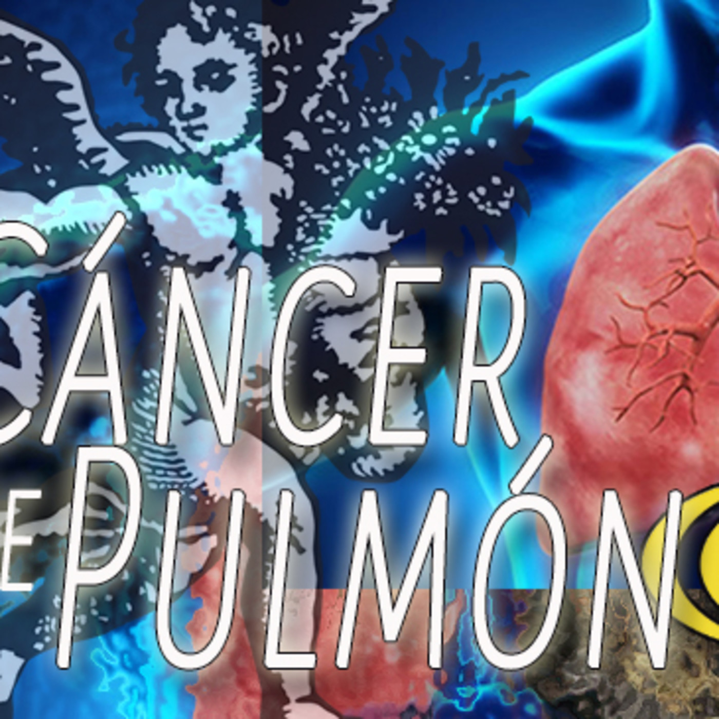 El Ángel de tu Salud - CÁNCER DE PULMÓN episode artwork