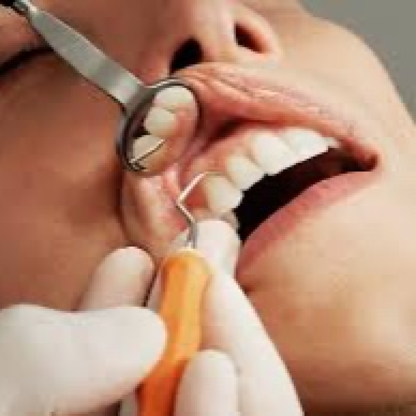 Factores de riesgo que afectan a nuestra salud dental con la odontóloga Bernarda Alcántara episode artwork