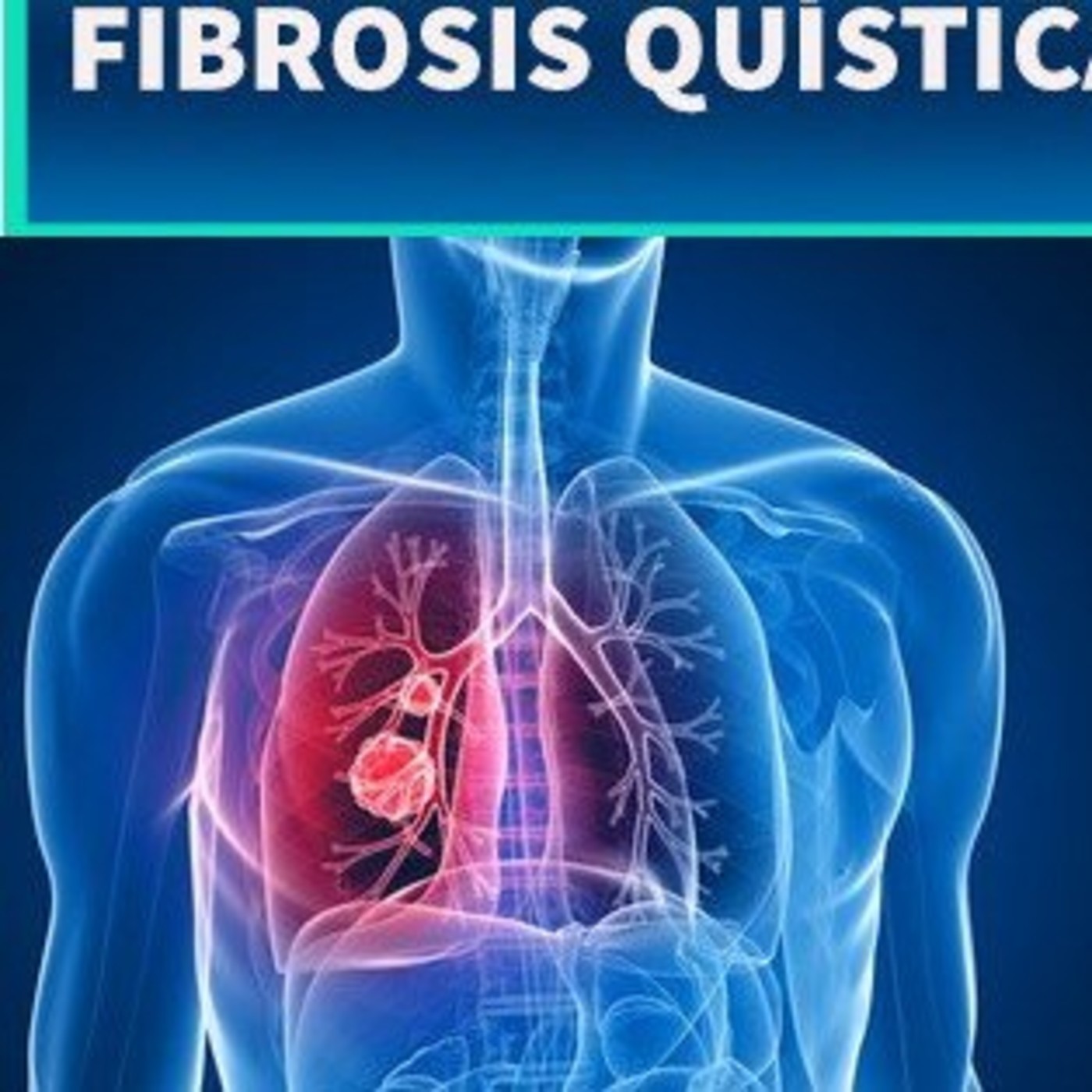 El Ángel de tu Salud - FIBROSIS QUÍSTICA episode artwork