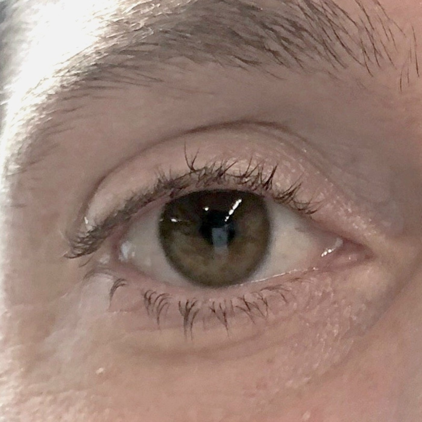 Ojo de Pez