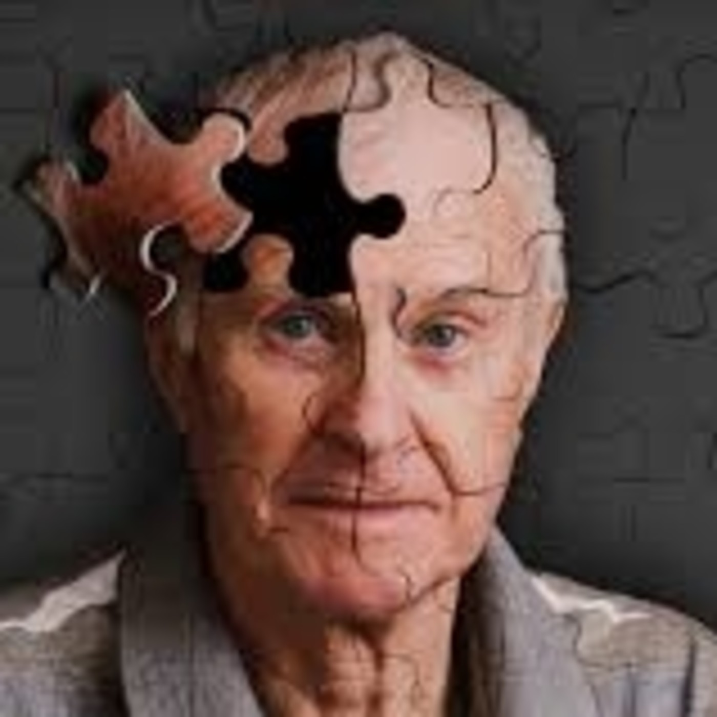 El Misterio del Alzheimer Documental Sonoro