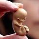 Despenilazacion del aborto
