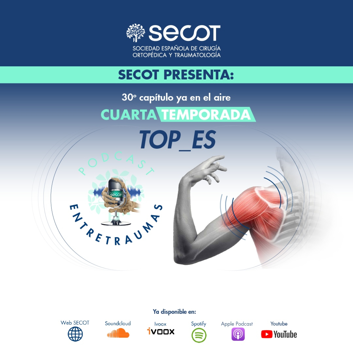 SECOT