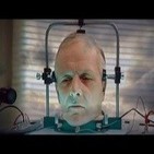 El primer transplante de cabeza -
