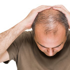 Vitaminas y Co2 para dar solución a la caÍda del cabello