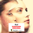 Acné Significado Emocional
