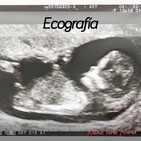 100. Ecografía
