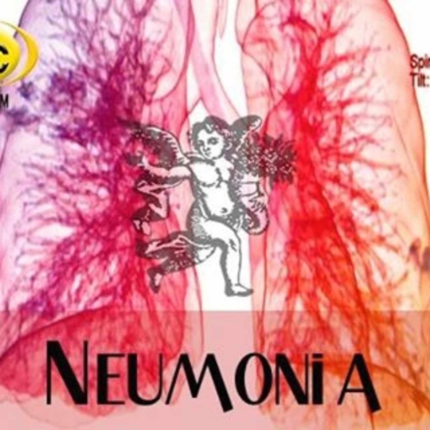 El Ángel de tu Salud - NEUMONÍA episode artwork