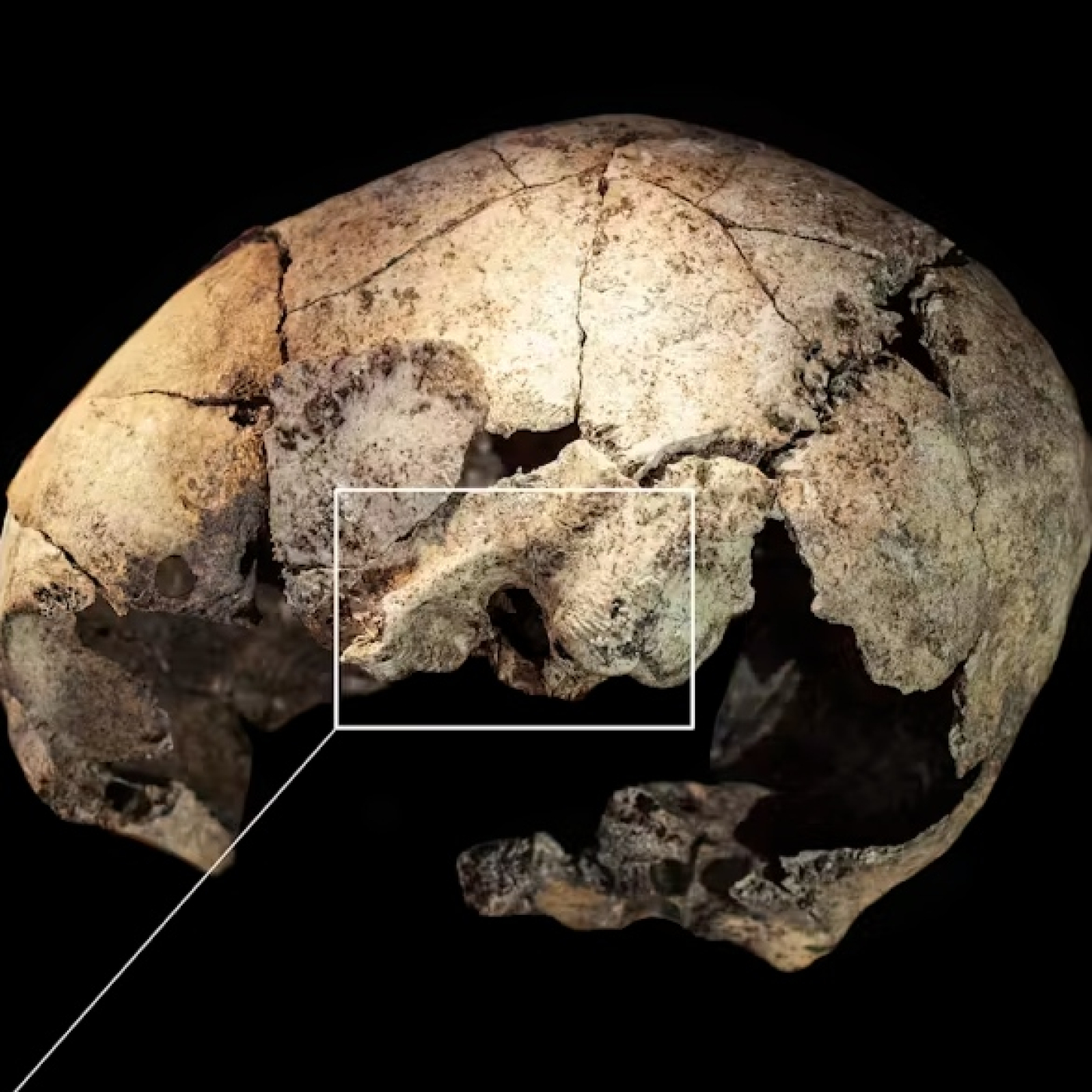 1291 - Cirugía Craneal Prehistórica - Y, después: El Origen de los primeros humanos