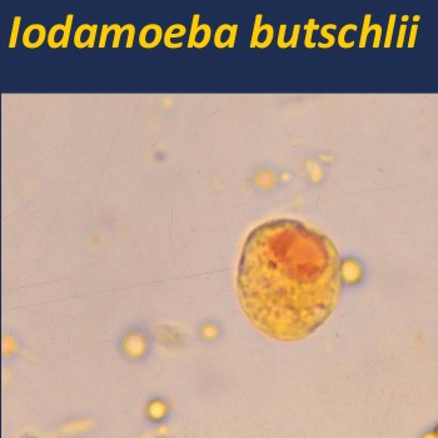 Entamoeba coli в кале. Entamoeba histolytica циста. Цисты Entamoeba. Iodamoeba Butschlii. Йодамеба Бючли.