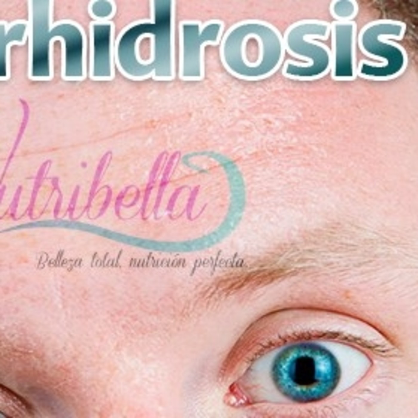HIPERHIDROSIS, Nutribella con Sinuhé Martínez