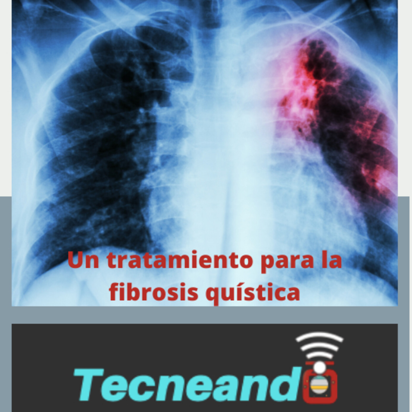 Tecneando