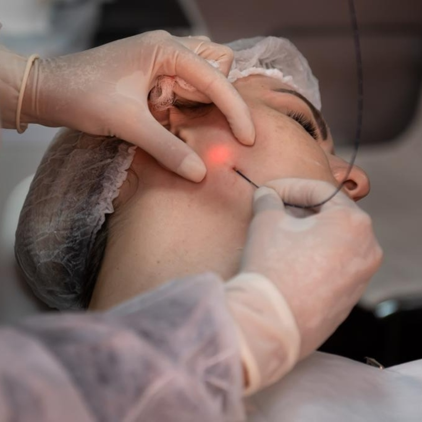 LIFTING FACIAL CON ENDOLASER, con Dra. Helga Rivera