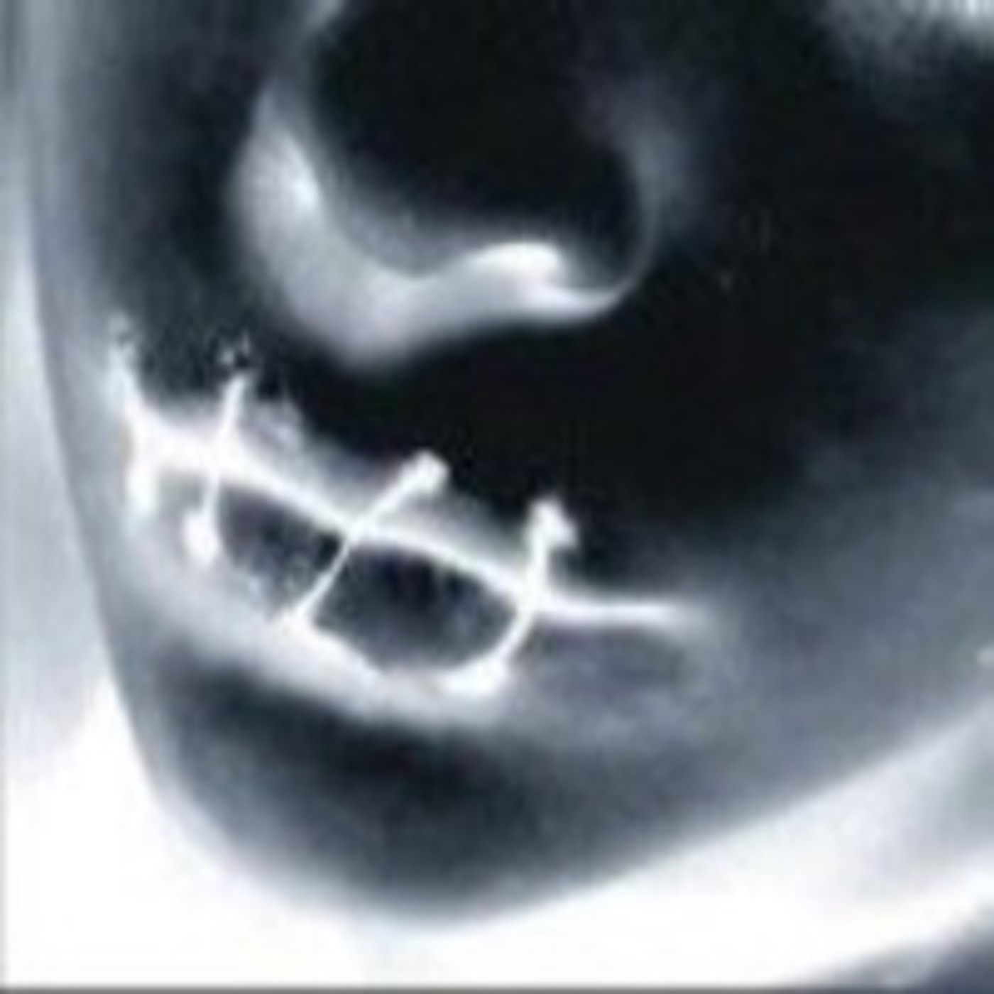 self/noise radio