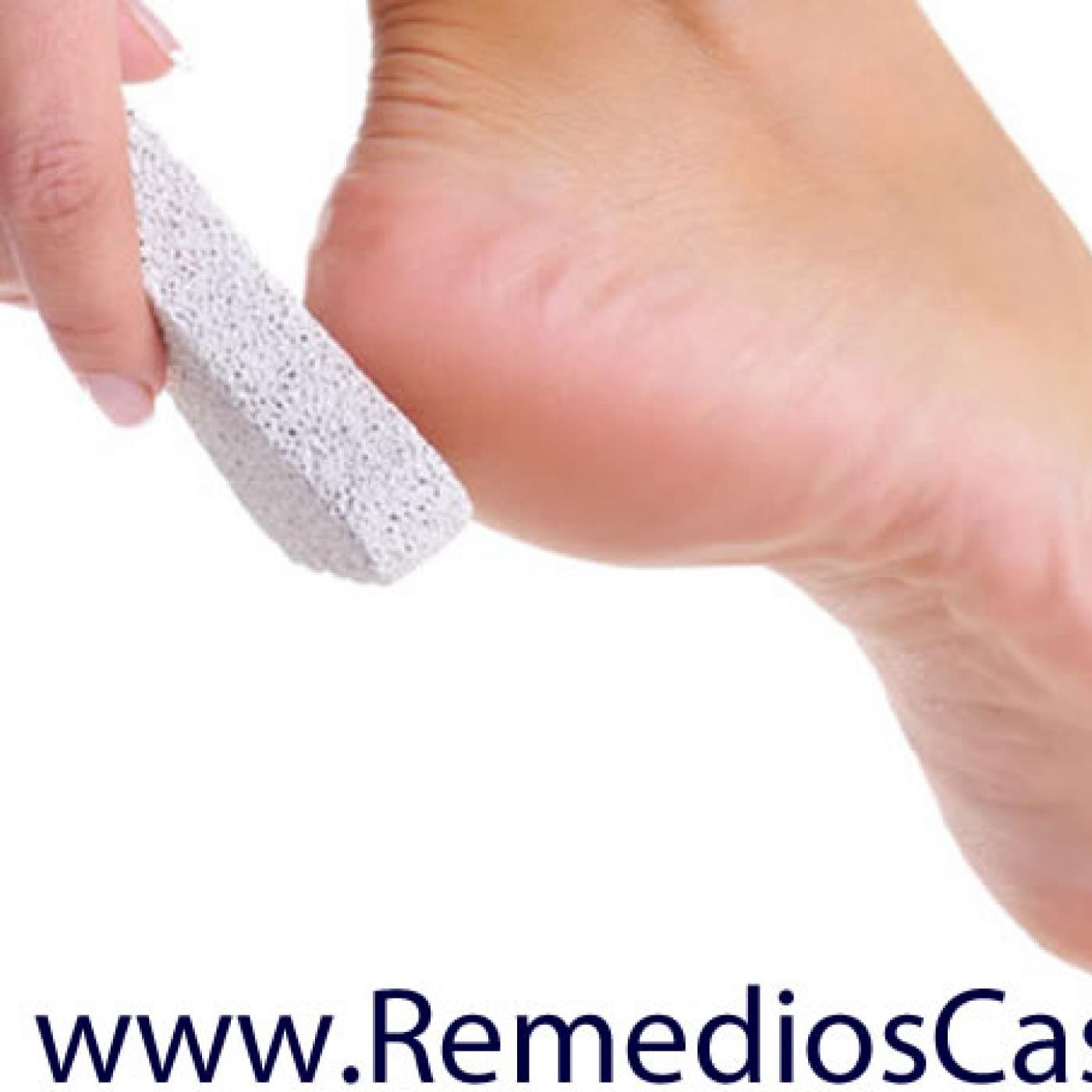 Remedios Caseros