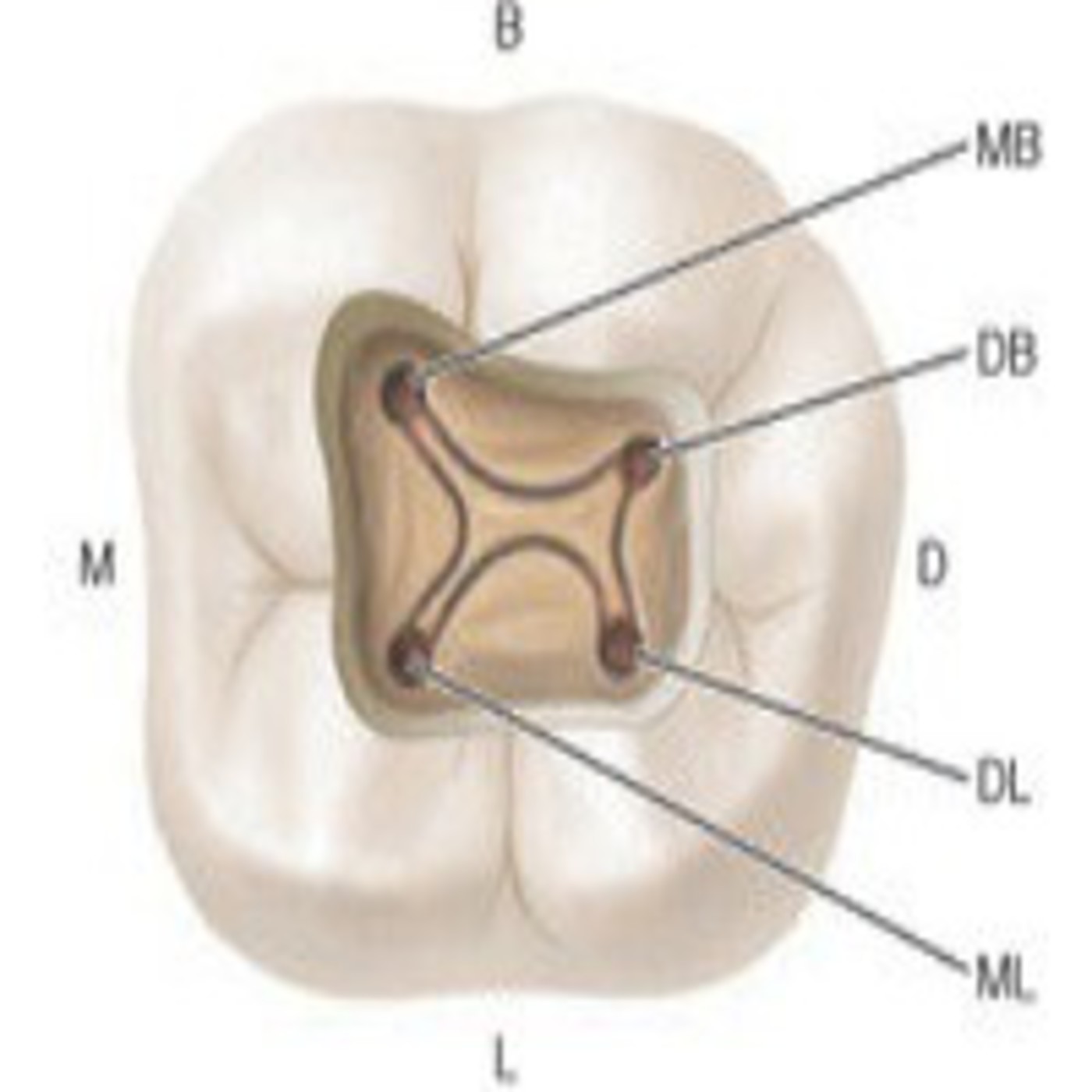 Unidad 3. Trepanación y acceso a la cámara pulpar