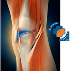 Cuanto cuesta un tratamiento en Clínicas de Rodilla BMT