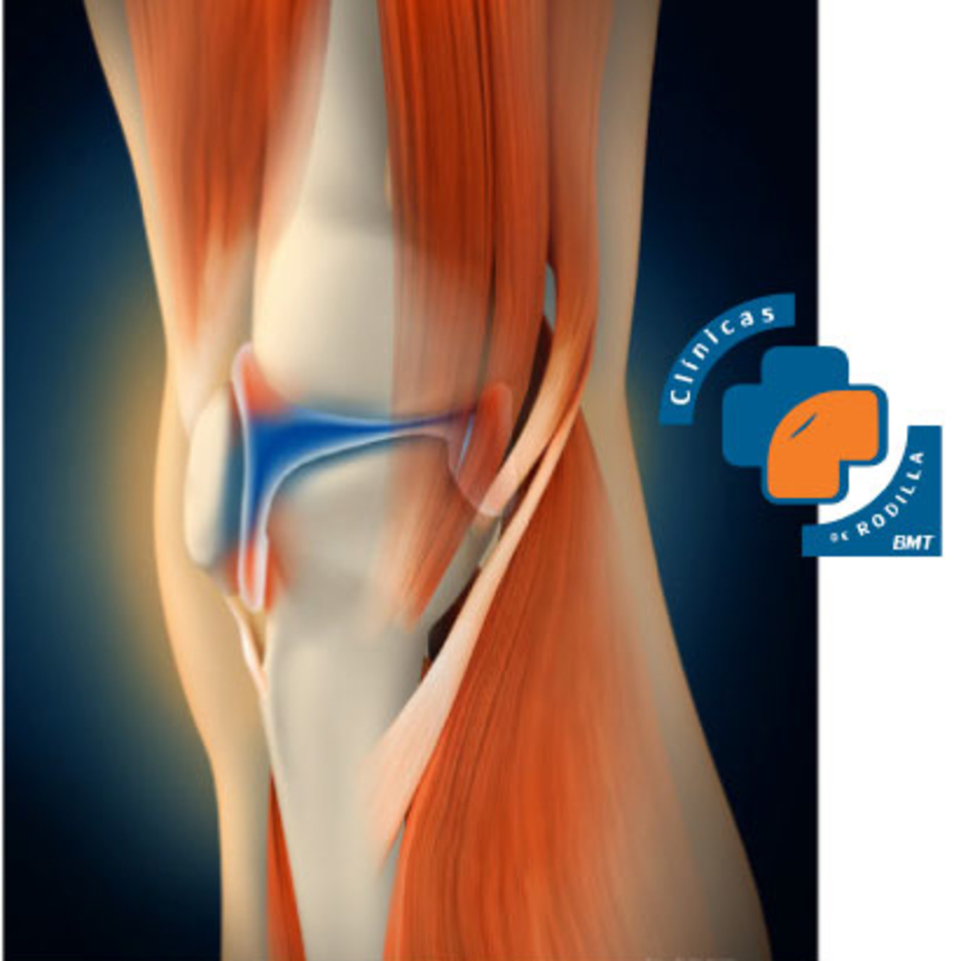 Clínicas de Rodilla BMT