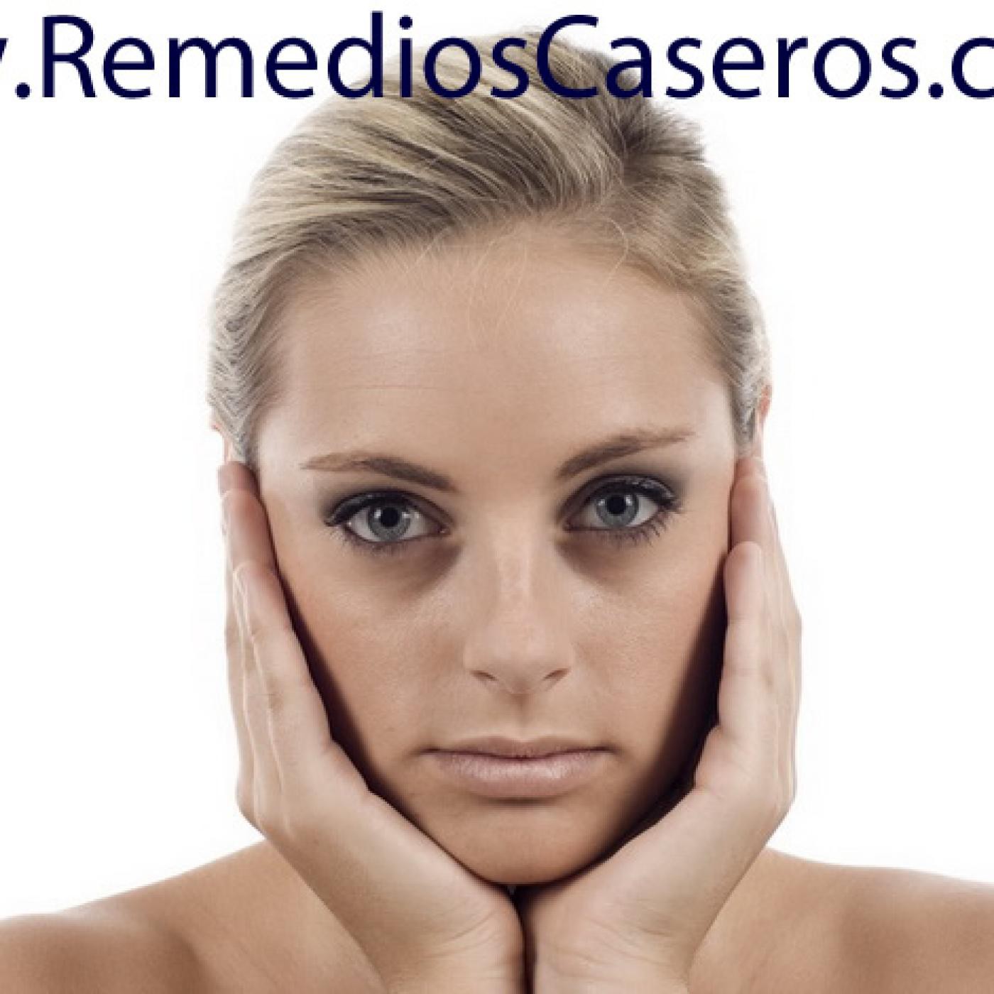 Remedios Caseros