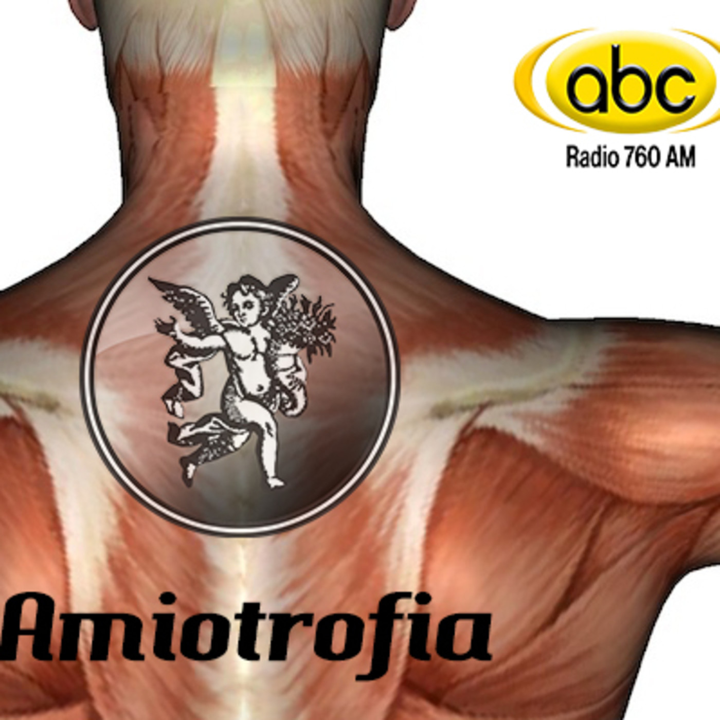 El Angel de tu Salud - AMIOTROFIA episode artwork