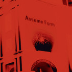 Globo FM - James Blake: Assume Form