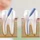 Concepto de Endodoncia