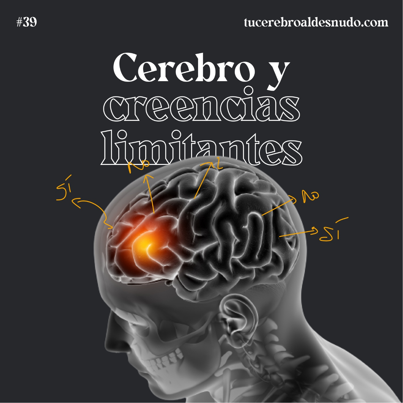 Cerebro Injodible®