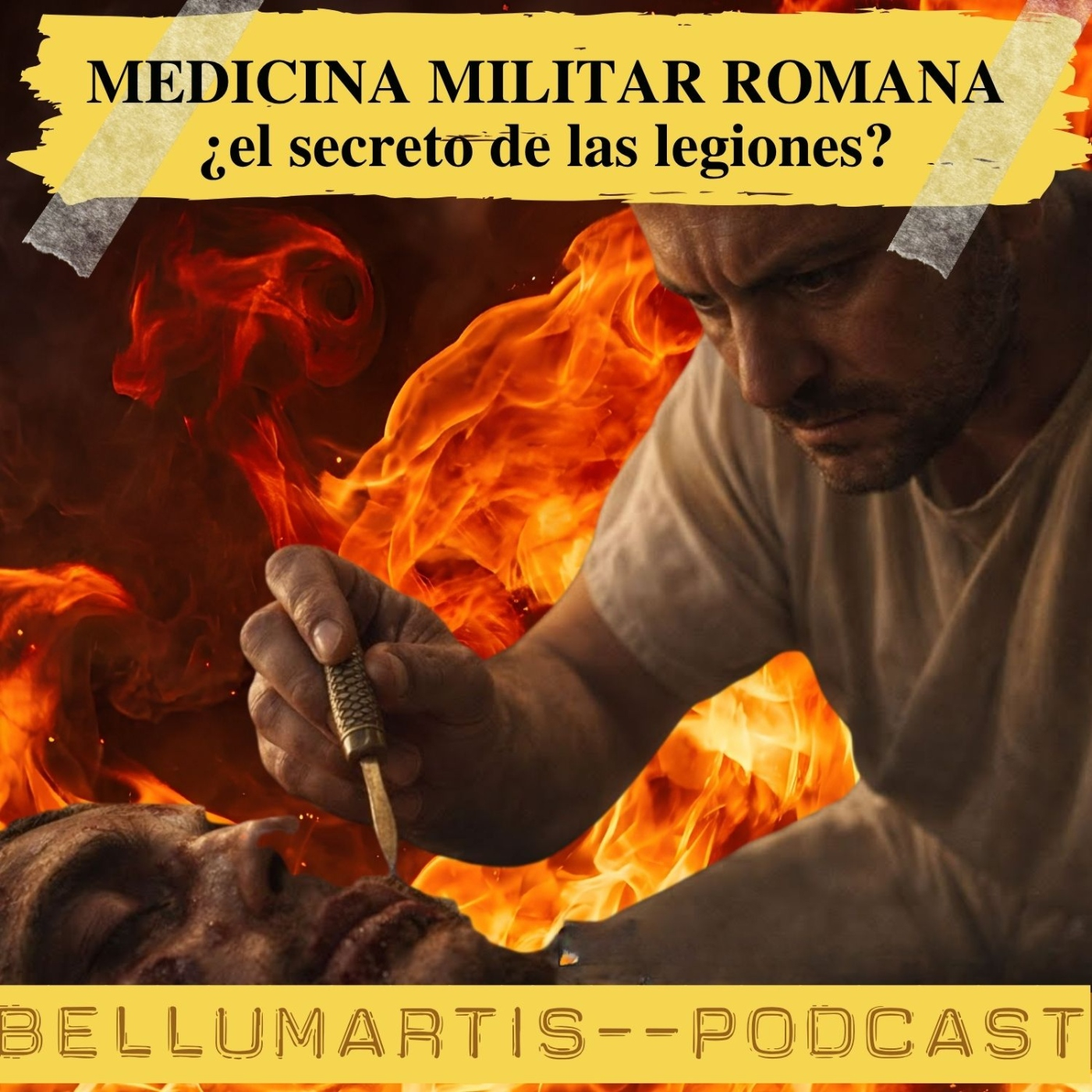 ¿Cómo sobrevivían los romanos a una flecha en el ojo? MEDICINA MILITAR DEL IMPERIO ROMANO * FRANCISCO A. AGUADO - Acceso anticipado