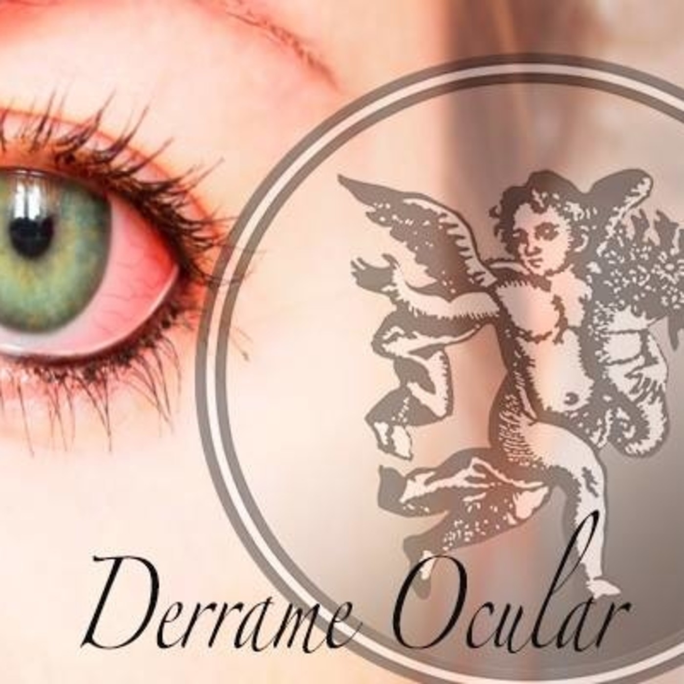 El Ángel de tu Salud -DERRAME OCULAR episode artwork