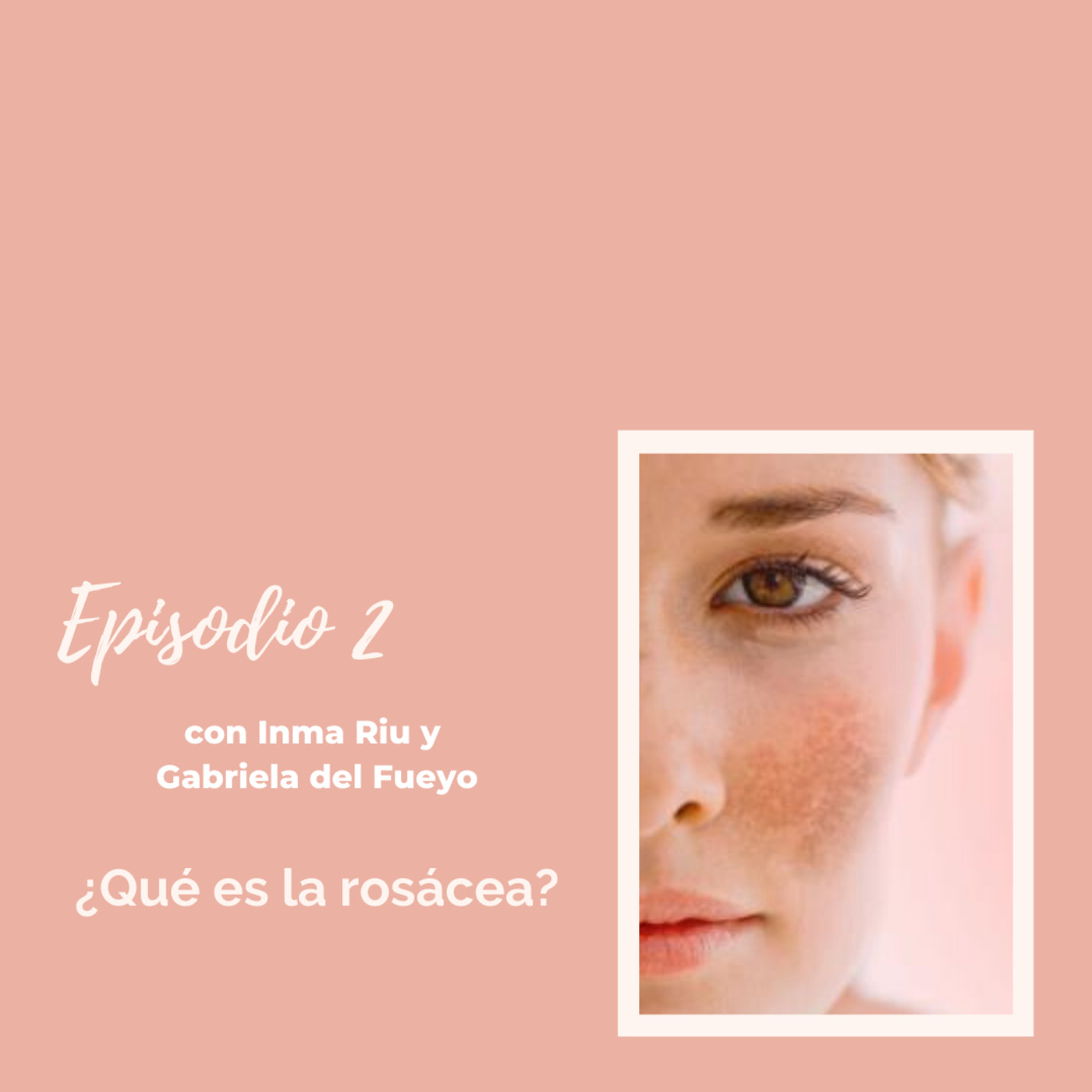 Ep. 2 - ¿Qué es la rosácea? ¿Cómo podemos tratarla?