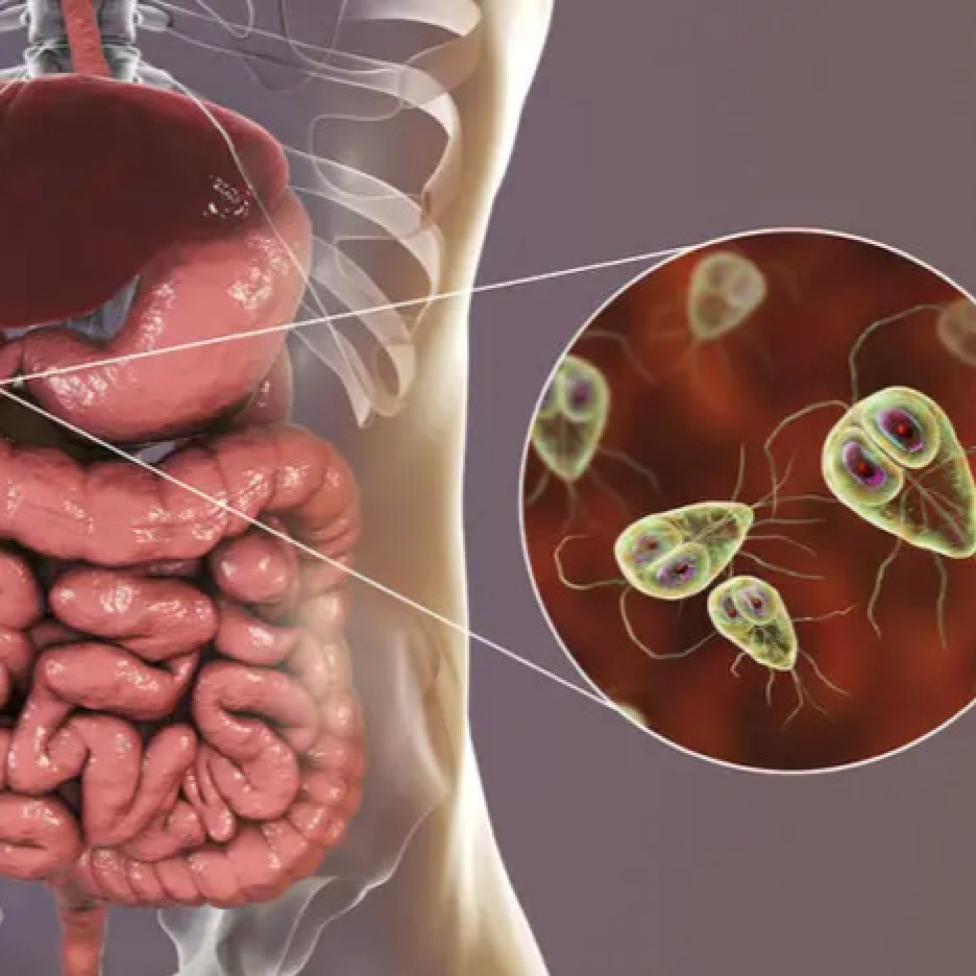 ¿Qué es la giardiasis y cómo combatirla?