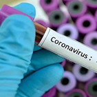 Voces del Misterio ESPECIAL: LAS SOSPECHAS DEL CORONAVIRUS COVID-19,en 'Crimen y Sospecha', Élite Radio