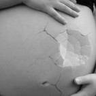 E 07 Abortos espotáneos, ¿más habituales de lo que creías?