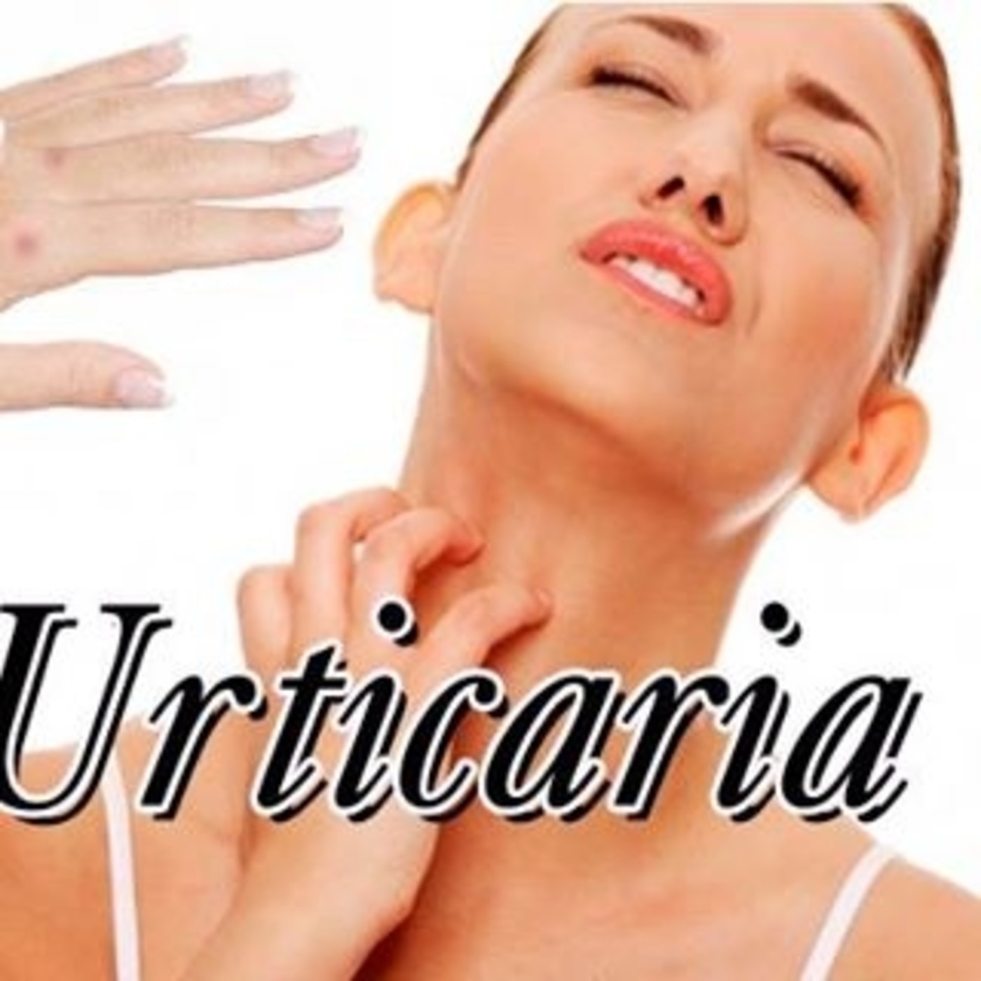 El Ángel de tu Salud - URTICARIA episode artwork