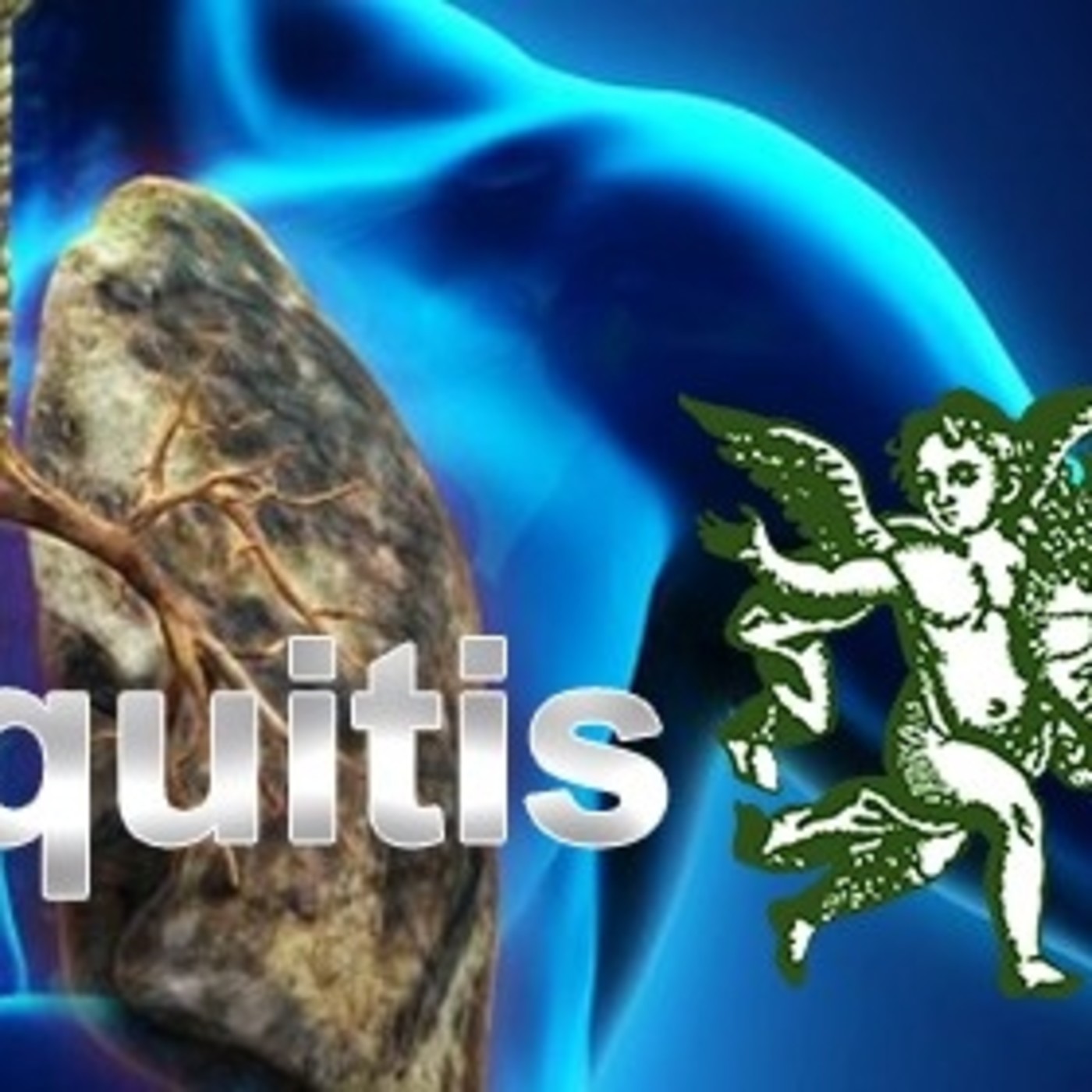 El Ángel de tu Salud - BRONQUITIS