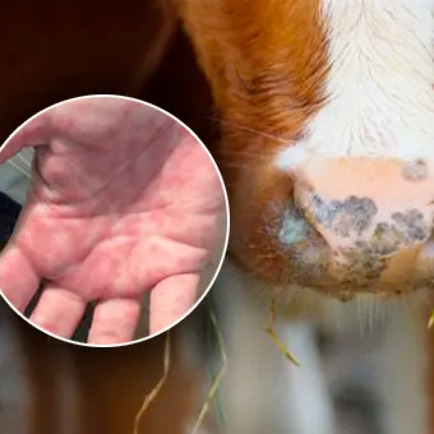 ¿Qué es la brucelosis? Conozca los riesgos, síntomas y cómo prevenirla