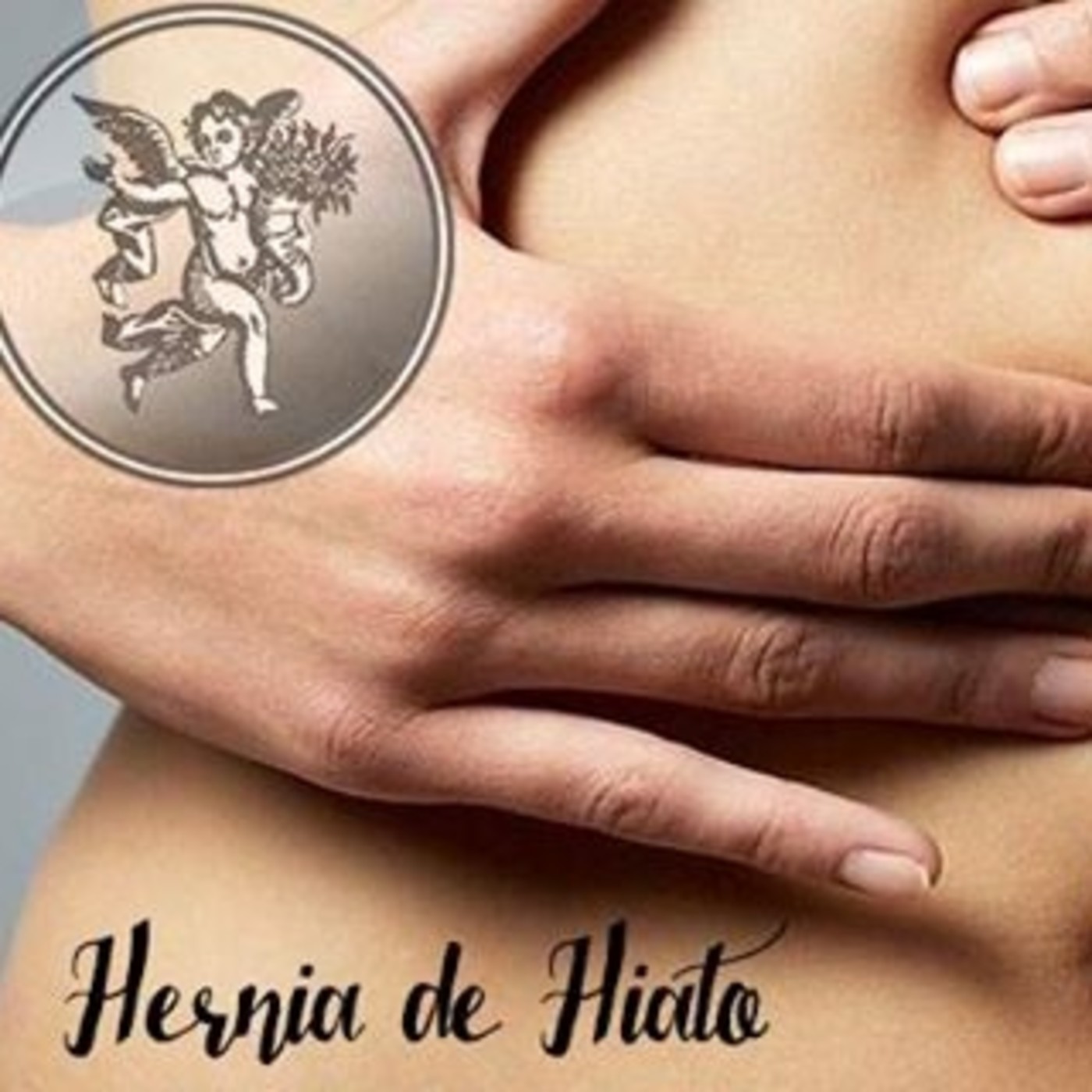 El Ángel de tu salud - HERNIA DE HIATO