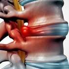 ¿Dolor de Espalda? Consejos del Doctor Manuel de la Torre