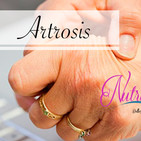 Nutribella - ¿QUÉ ES LA ARTROSIS?