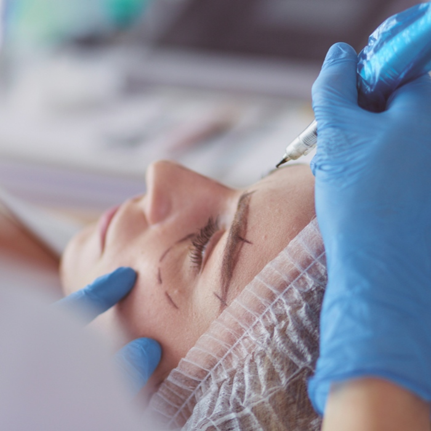 LIFTING FACIAL CON ENDOLASER, con Dra. Helga Rivera