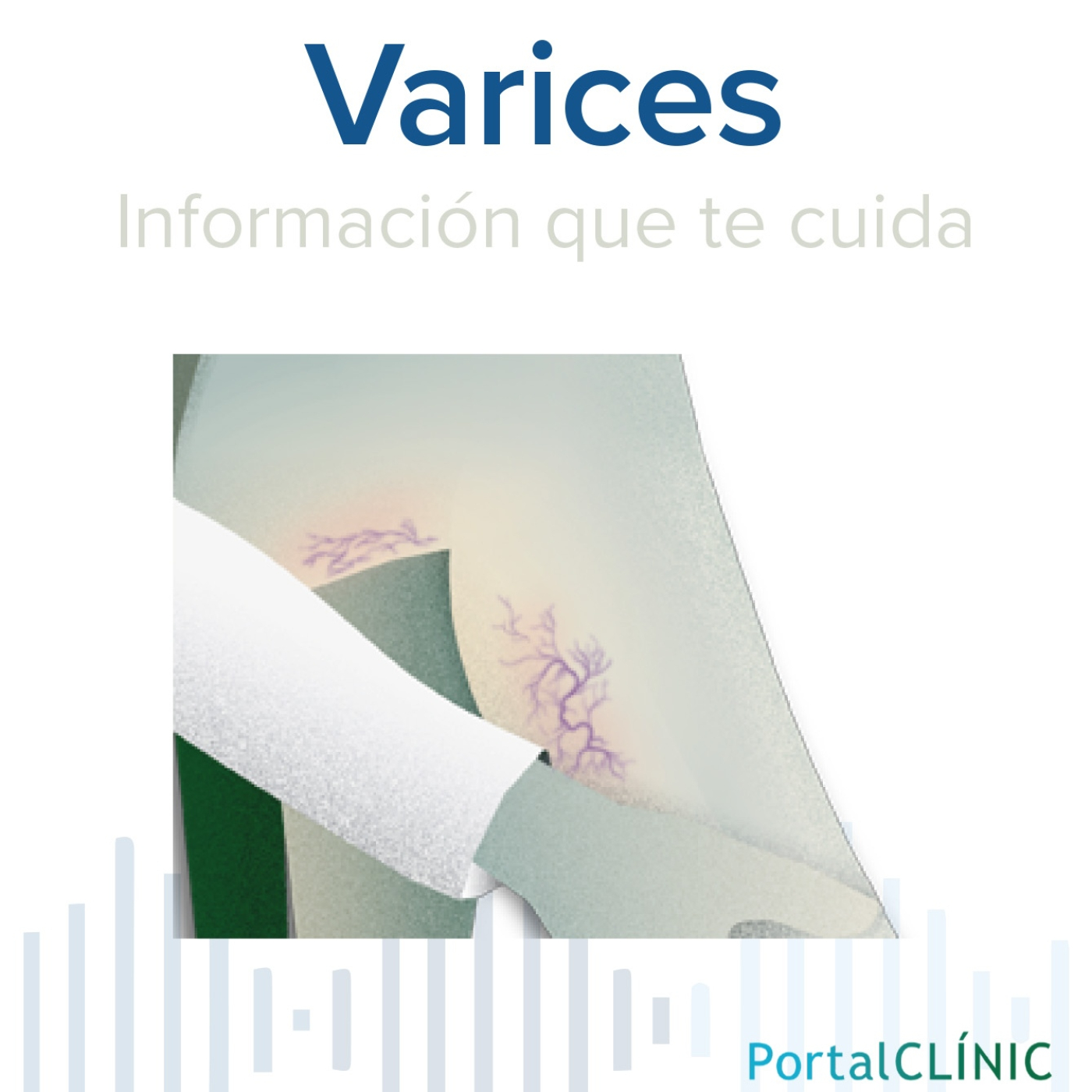 'Las varices son venas que se dilatan' | Varices | Podcast episode artwork