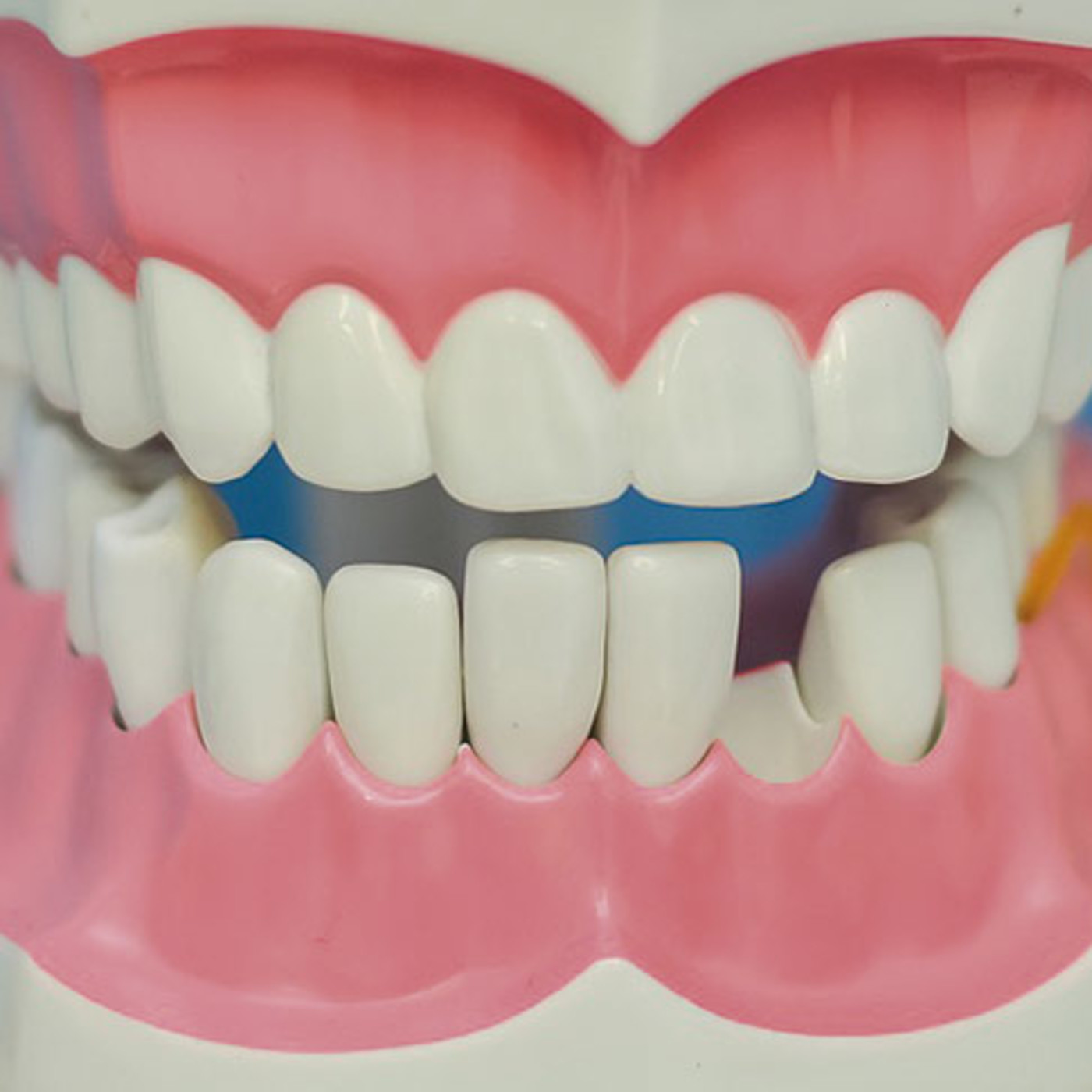Salud Bucodental