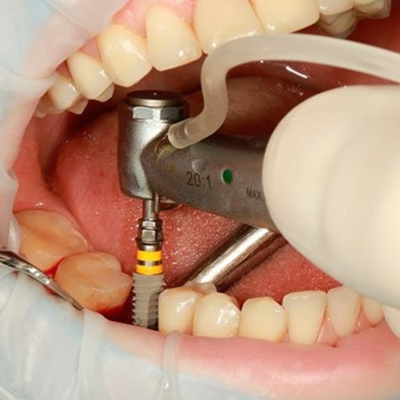 Salud Bucodental